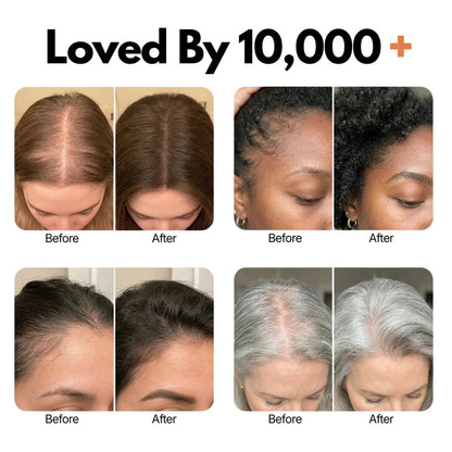 Jora Beauty REROOT Hair Growth Serum