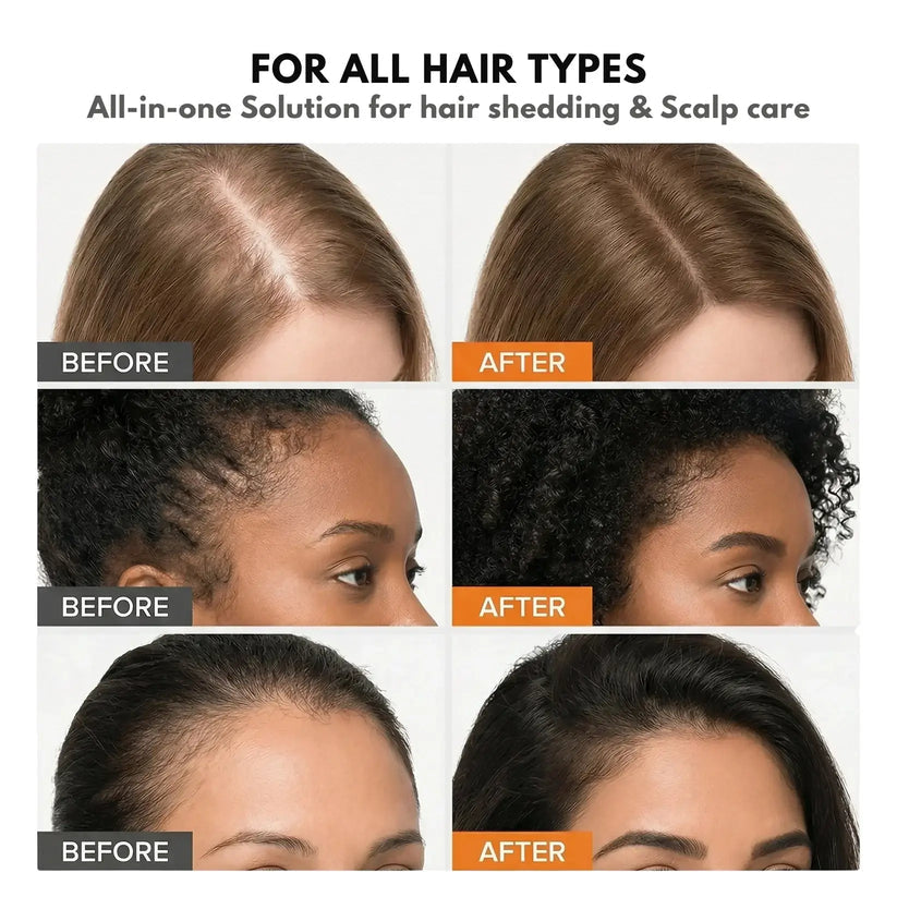 Jora Beauty REROOT Hair Growth Serum