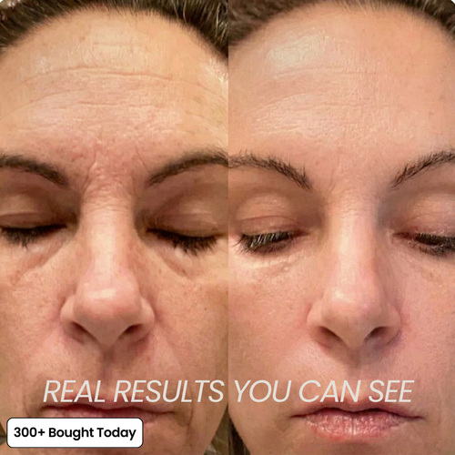 JORA Volumide™ Collagen Rebuild Balm