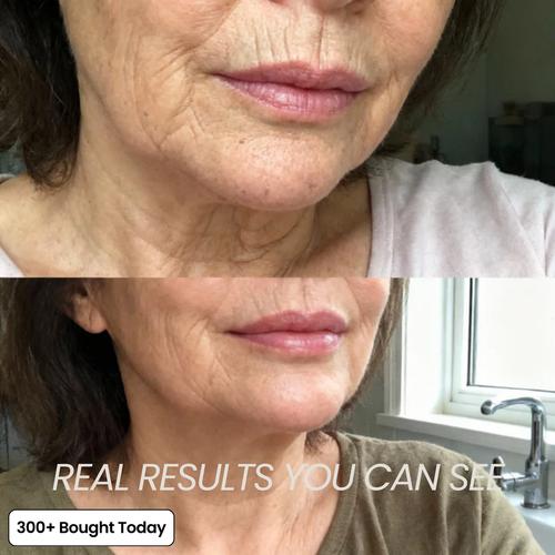 JORA Volumide™ Collagen Rebuild Balm