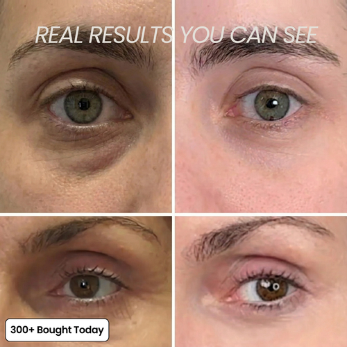 JORA Volumide™ Collagen Rebuild Balm