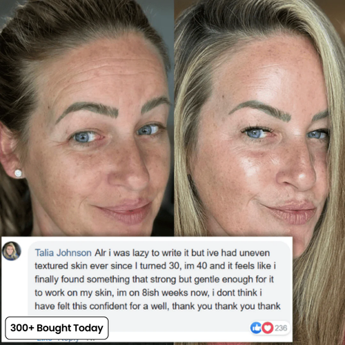 JORA Volumide™ Collagen Rebuild Balm