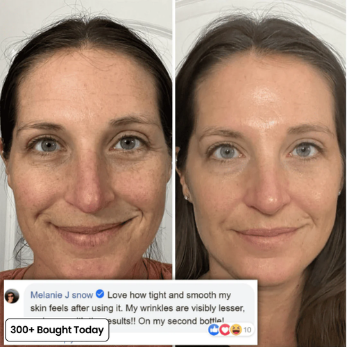 JORA Volumide™ Collagen Rebuild Balm