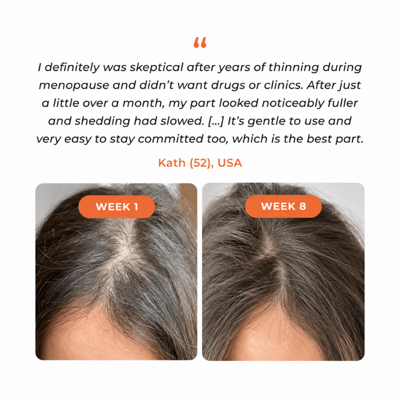 Jora Beauty REROOT Hair Growth Serum