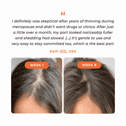Jora Beauty REROOT Hair Growth Serum